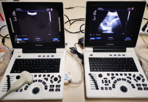 TEKNOVA Ultrasound System